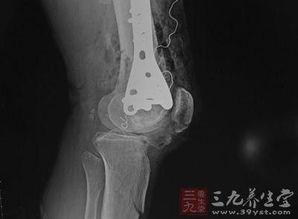 伴侣愈合高清在线观看,高清在线观看，情感疗愈之旅  第3张